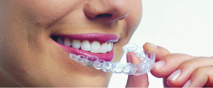 Lady holding an Invisalign tray up to her mouth
